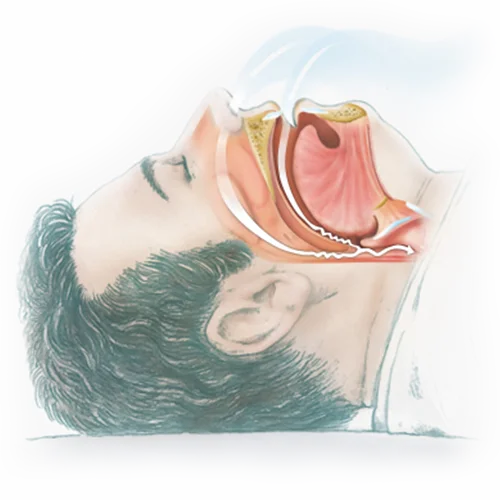 disturbi-del-sonno_0000s_0001_8261BB3B-8C88-44D9-A5EF-FB8916B74222