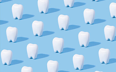 Lo sbiancamento dentale per un sorriso luminoso